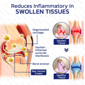 FLYCARE™ Bee Venom Joint and Bone Therapy Cream
