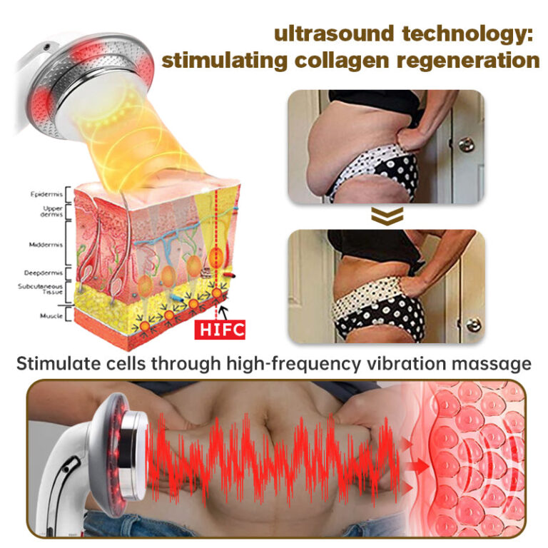 Furzero™ EMS Ultrasonic Far Infrared Anti-Cellulite Massager