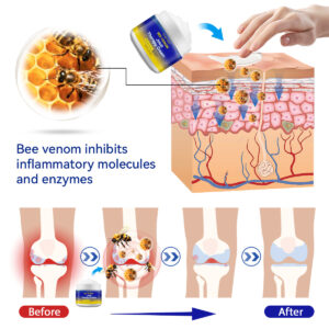 Ourlyard™ Bee Venom Joint Therapy Cream: Relieve stiffness and swelling