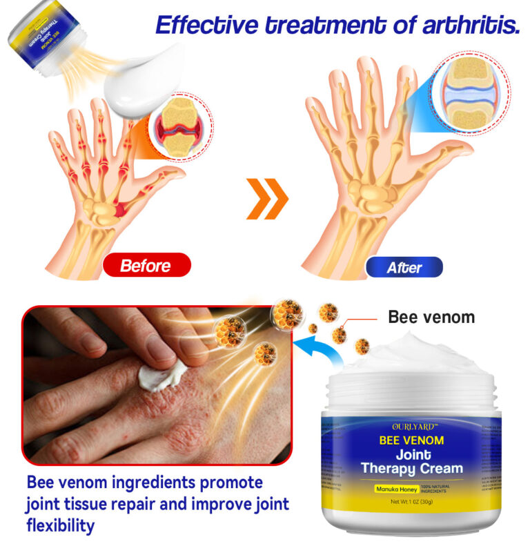 Ourlyard™ Bee Venom Joint Therapy Cream: Relieve stiffness and swelling