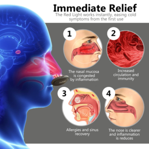 Oveallgo™ RespiRelief ULTRA Red Light Nasal Therapy Instrument