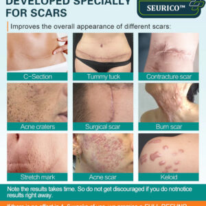 Seurico™ Advanced Scar Spray For All Types of Scars