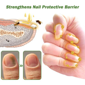 Seurico™ Nail Defense Bee Venom Treatment Serum pro