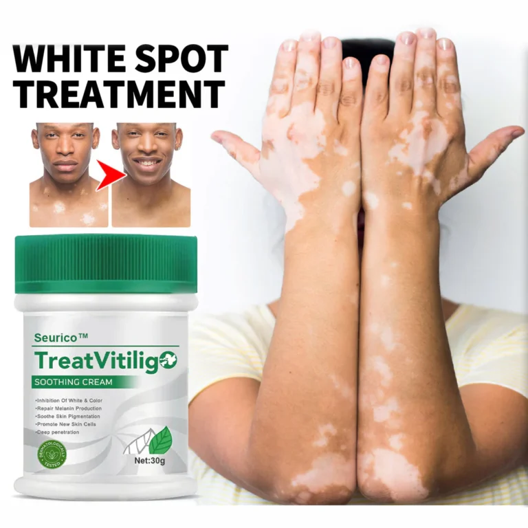 Seurico™ TreatVitiligo Soothing Cream - Image 2