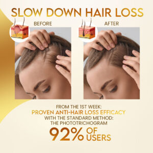 Stovis™ Biotin Premium Boost Hair Growth Spray