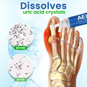 AEXZR™ Gout Care Relief Gel