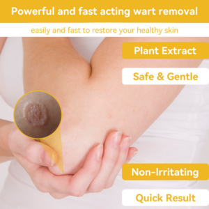 Bee Venom Wart & Moles Removal Cream