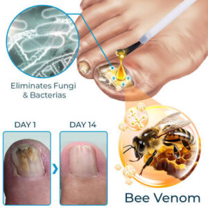 FLYCARE™ Bee Venom Nail Fungus Treatment Elixir