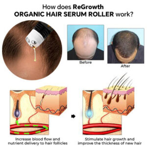 HZA™ ReGrowth Organic Hair Serum Roller