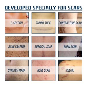 LOVILDS™ PREMIUM FORMULA Scar Gel