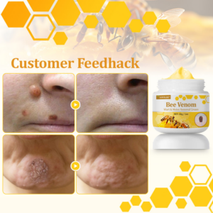 LOVILDS™ TagCure Bee Venom Wart & Moles Removal Cream