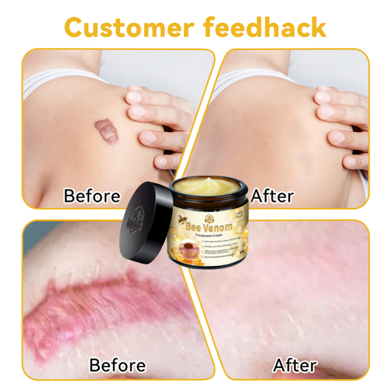 Lovilds™ Bee Venom Skin Treatment Cream