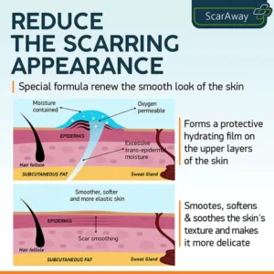 ScarRemove For All Types of Scars