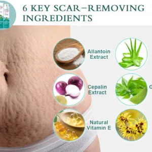 ScarRemove For All Types of Scars