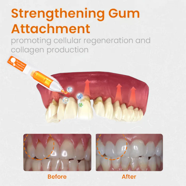 AEXZR™ Gum Repair Treatment Ampoules