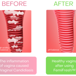 AEXZR™ Vaginal Cleaning Patch