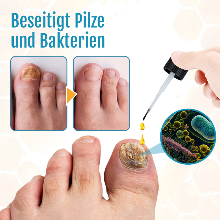 Biancat™ FungiOut Bienengift Nagelbehandlungsessenz