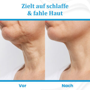 Ceoerty™ EternaLIFT Ultra Straffende Hautcreme