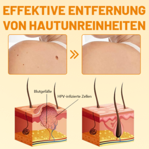 Ceoerty™ VenomErase Hauterneuerungscreme