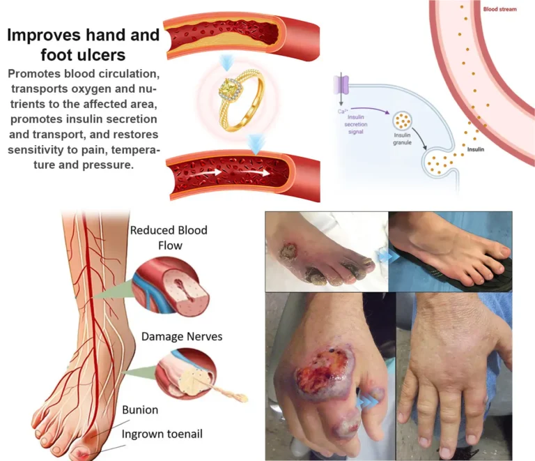 DIYSTAR™ Lymphvity MagneTherapy Germanium Ring