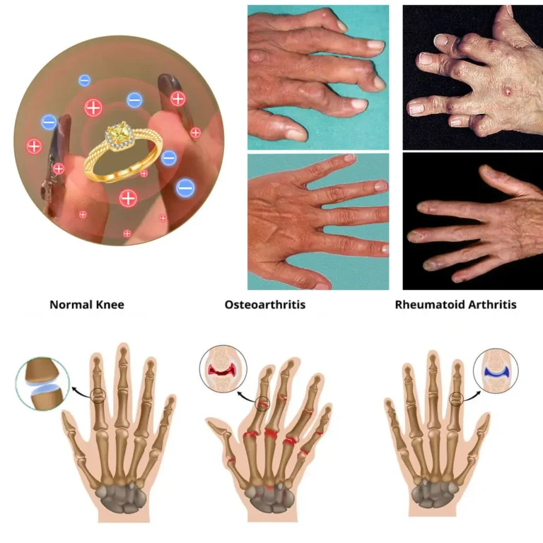 DIYSTAR™ Lymphvity MagneTherapy Germanium Ring