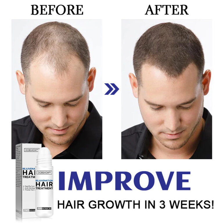 Dobshow™ Hair Rejuvenation Treatment