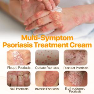 FLYCARE™ Psoriasis Anti-Bacterial Cream