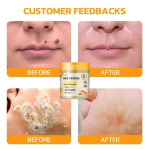 Furzero™ Bee Venom Skincare Treatment Pads