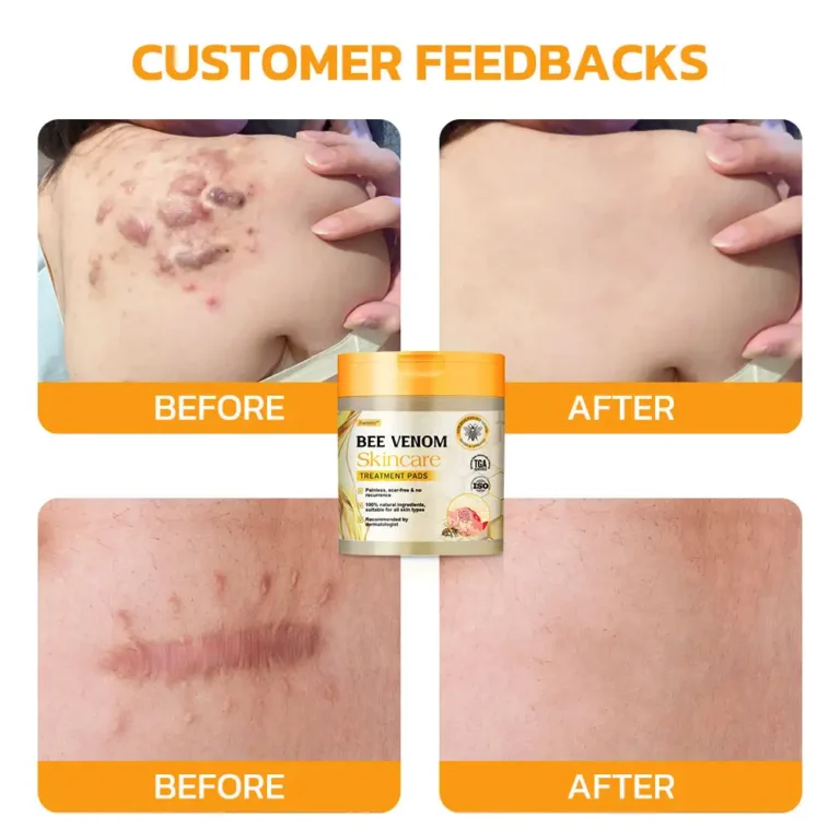 Furzero™ Bee Venom Skincare Treatment Pads