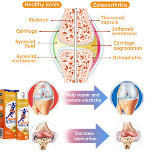 Furzero™ Turmeric Arthritis Spray