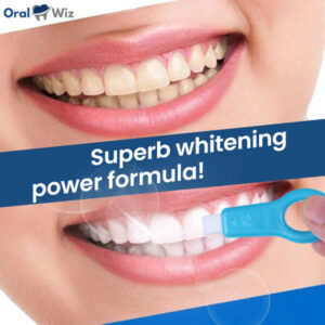 OralWiz™ Whitening & Repair Teeth Kit