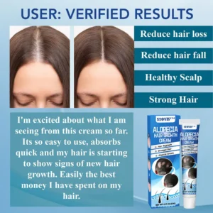 STOVIS™ Alopecia Recovery Hair Regrowth Cream