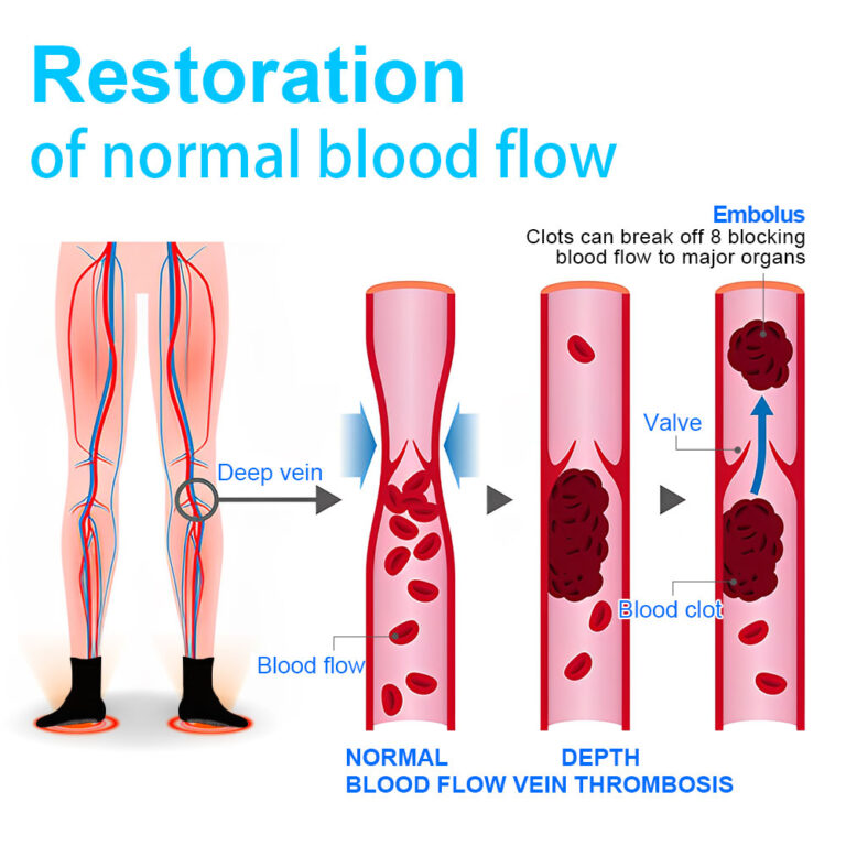 𝐋𝐮𝐜𝐤𝐲𝐒𝐨𝐧𝐠® 𝐈𝐨𝐧𝐓𝐞𝐜𝐡𝐏𝐫𝐨 𝐒𝐮𝐩𝐞𝐫 𝐃𝐞𝐭𝐨𝐱 𝐒𝐥𝐢𝐦𝐦𝐢𝐧𝐠 𝐒𝐨𝐜𝐤𝐬