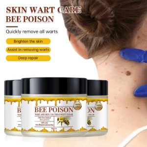 Bee poison Wart and Mole Removal Treatment Cream