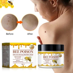 Bee poison Wart and Mole Removal Treatment Cream