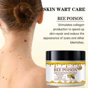 Bee poison Wart and Mole Removal Treatment Cream