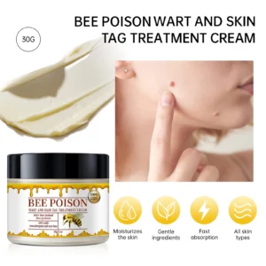 Bee poison Wart and Mole Removal Treatment Cream