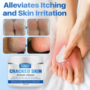 FLYCARE™ Cracked Skin Repair Cream