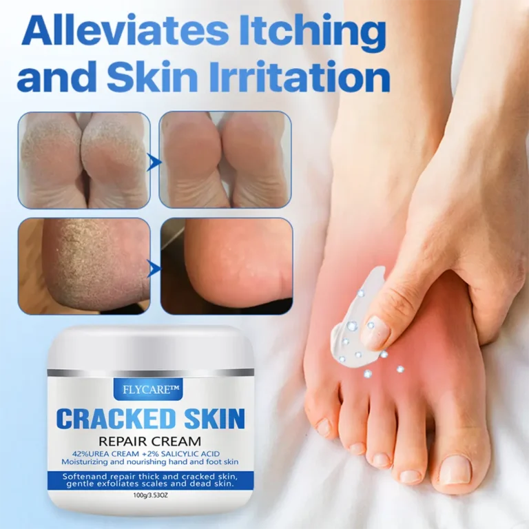 FLYCARE™ Cracked Skin Repair Cream