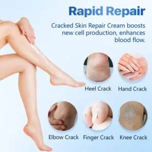 FLYCARE™ Cracked Skin Repair Cream