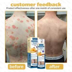 FLYCARE™ PsoriaHeal Bee Venom Psoriasis Treatment Spray