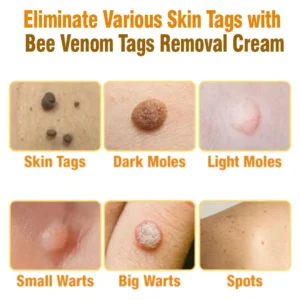 Lotmay™Australian Bee Venom Tags Removal Cream