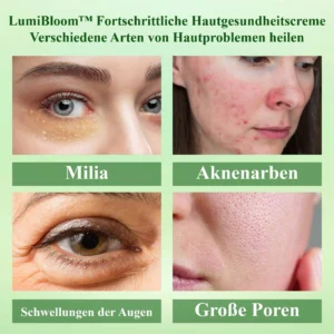 LumiBloom™ Fortschrittliche Hautgesundheitscreme