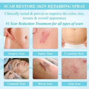 ScarEase™ Premium SkinRecovery Spray