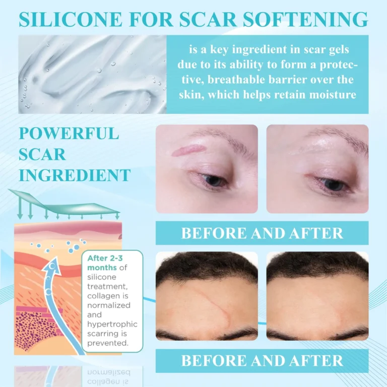 ScarEase™ Premium SkinRecovery Spray