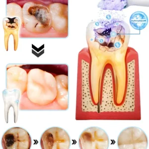 DOCTIA™ TeethRestoration Mineralpulver