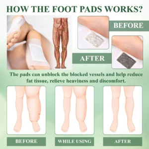 DetoxFlow™ SwellRelief Lymphatic Foot Pads