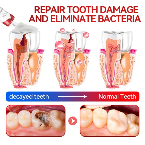 Dormorna ™ SP10+ Probiotic Regenerative Silicon Repair Cavity Whitening Toothpaste