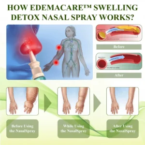 EdemaCare™ SwellingDetox Nasal Spray