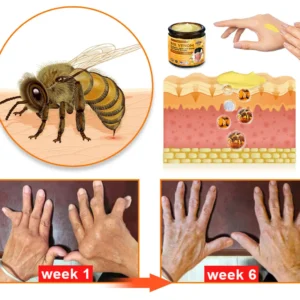 Furzero™ Bee Venom & Turmeric Joint and Bone Pain Relief Cream (Specializes in Joint and Arthritis Pain & AAOS Recommends)